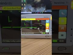 Δείτε γιατί να επιλέξετε Mindray BeneView T1 Patient Monitor LCD οθόνη με μπροστινό κάλυμμα