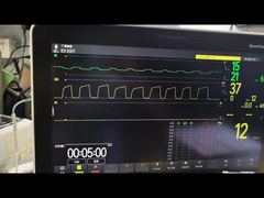 Προβολή Mindray AG Module AG And O2 Module MMS Module PN 115-023943-00 Demo